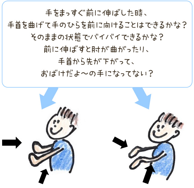 手をまっすぐ前に伸ばした時、手首を曲げて手のひらを前に向けることはできるかな？